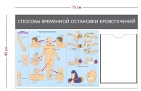 Стенд «Способы временной остановки кровотечений» (1 карман А4 + 1 плакат)